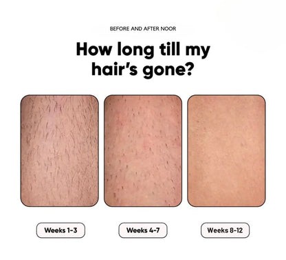 GlowSilk IPL Hair Removal Handset