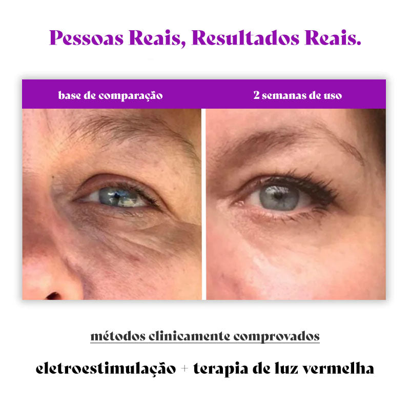 ReviPlus - Solución Clínicamente Comprobada para Eliminar Ojeras y Bolsas en Solo 2 Semanas!